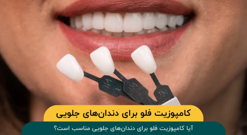 کامپوزیت-فلو-دندان‌-جلویی